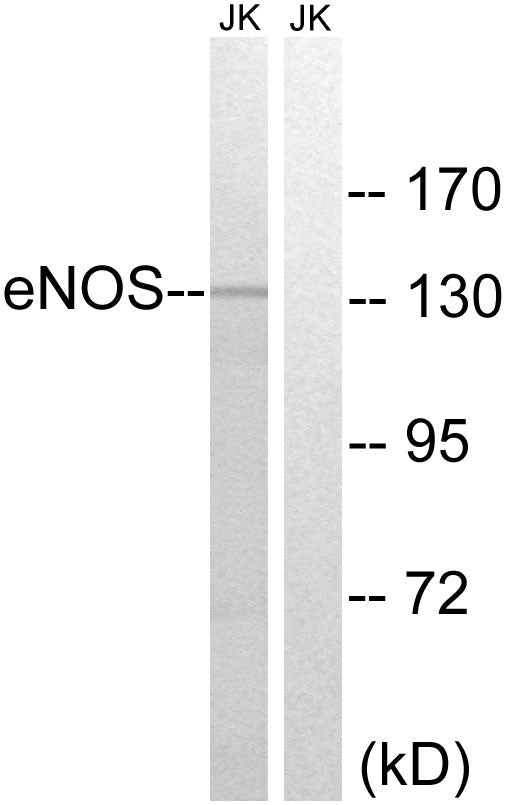 Anti-eNOS Rabbit Polyclonal Antibody