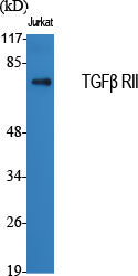 Anti-TGF beta Receptor II Rabbit Polyclonal Antibody