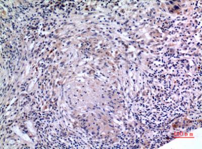 Anti-IL-6 Rabbit Polyclonal Antibody