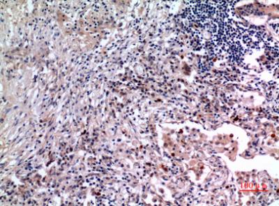 Anti-IL-6 Rabbit Polyclonal Antibody