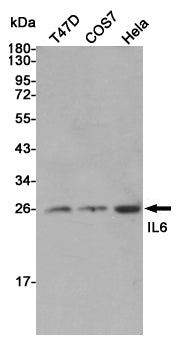 Anti-IL-6 Rabbit Polyclonal Antibody