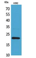 Anti-IL-6 Rabbit Polyclonal Antibody
