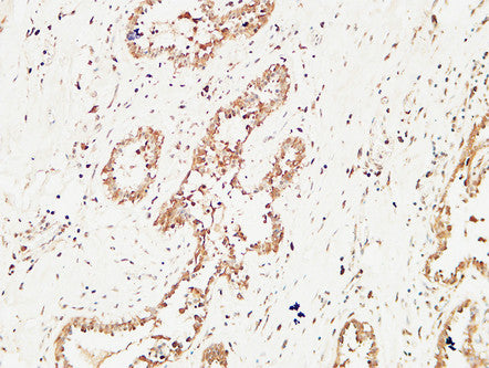 Anti-c-Kit Rabbit Polyclonal Antibody