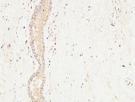 Anti-c-Kit Rabbit Polyclonal Antibody
