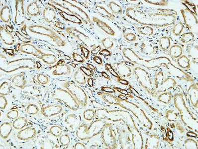 Anti-CD31 Rabbit Polyclonal Antibody