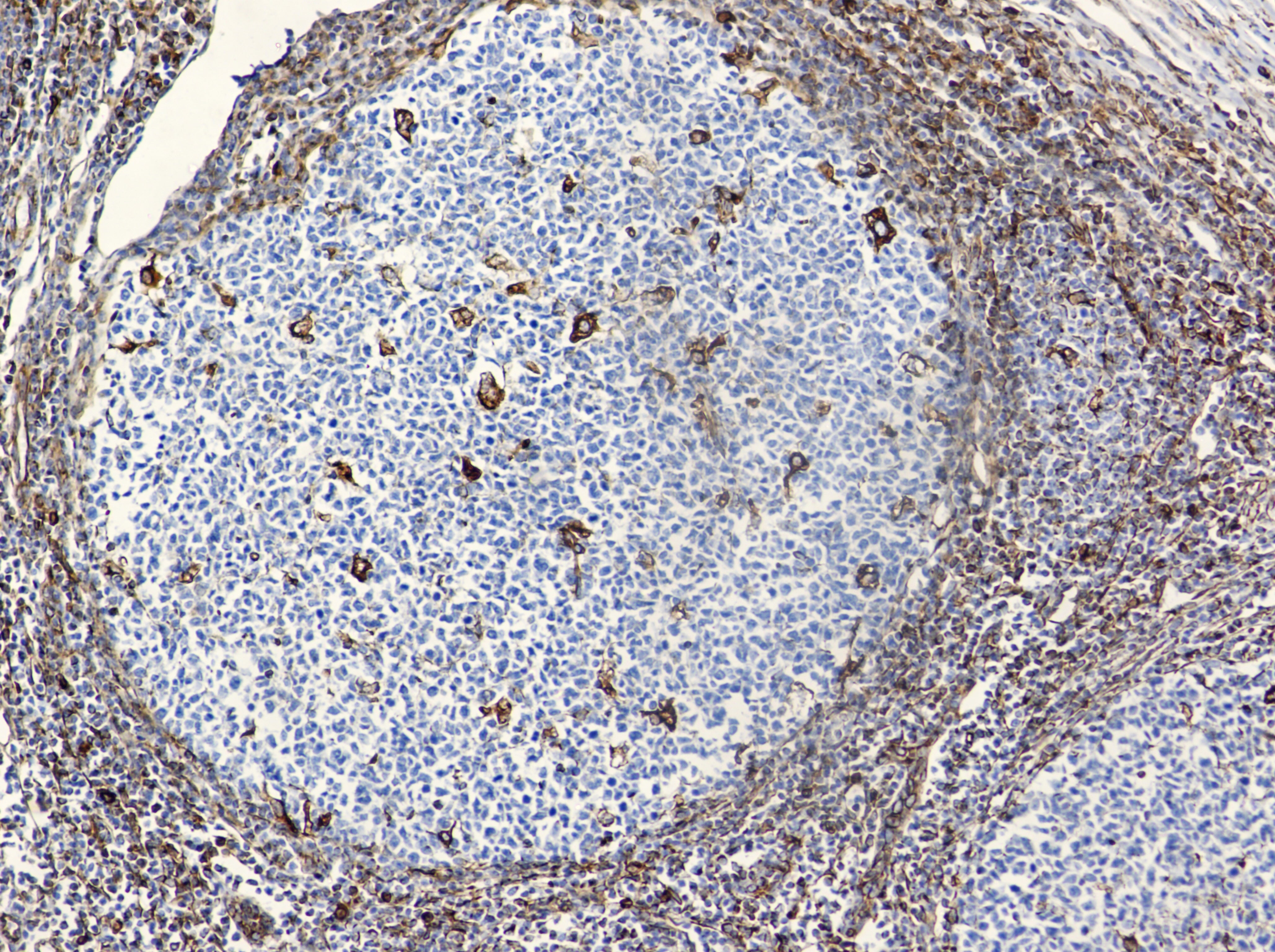 Anti-Vimentin (4F8) Mouse Monoclonal Antibody