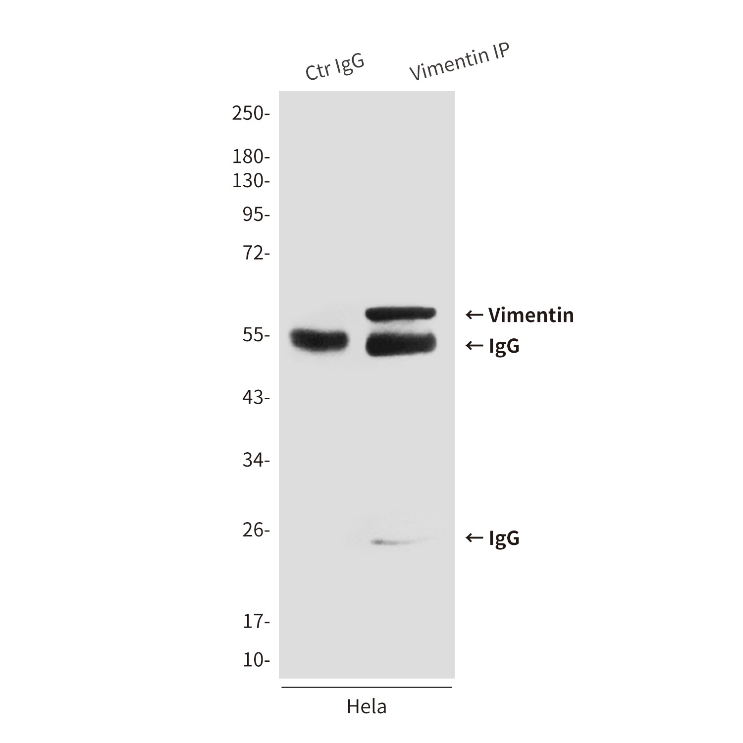 Anti-Vimentin (4F8) Mouse Monoclonal Antibody