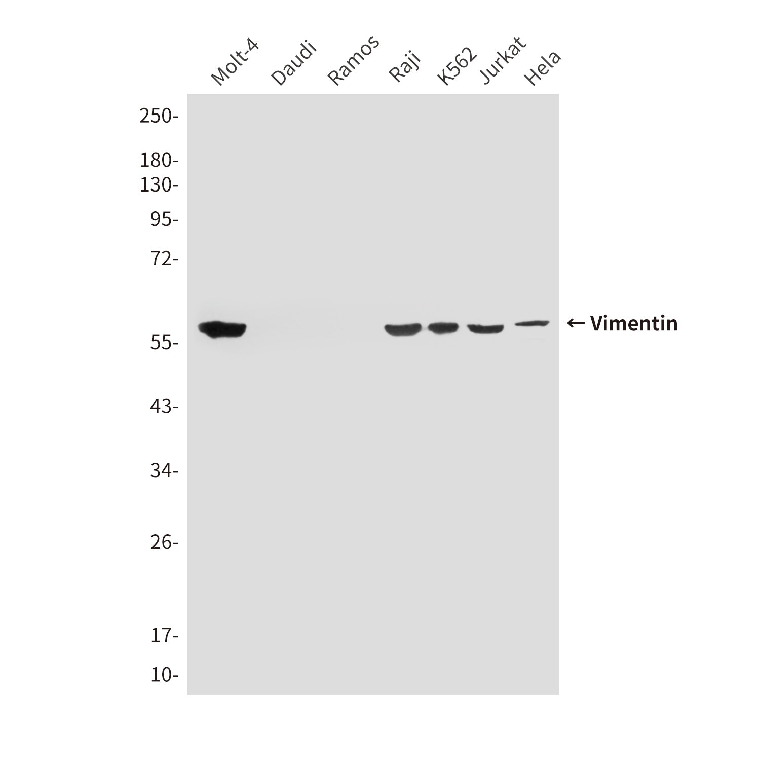 Anti-Vimentin (4F8) Mouse Monoclonal Antibody