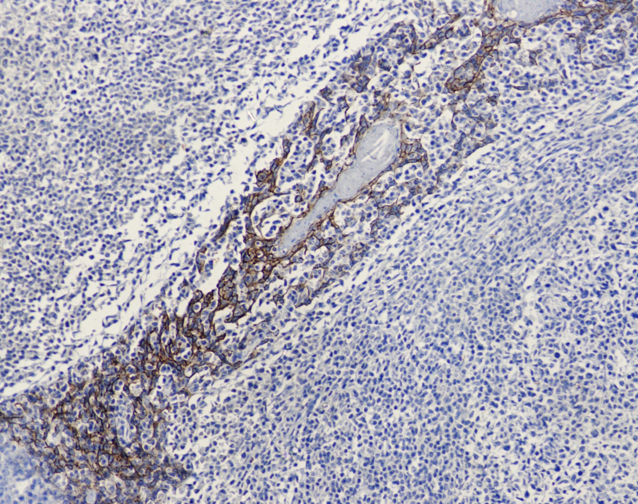 Anti-E Cadherin (6B10) Mouse Monoclonal Antibody
