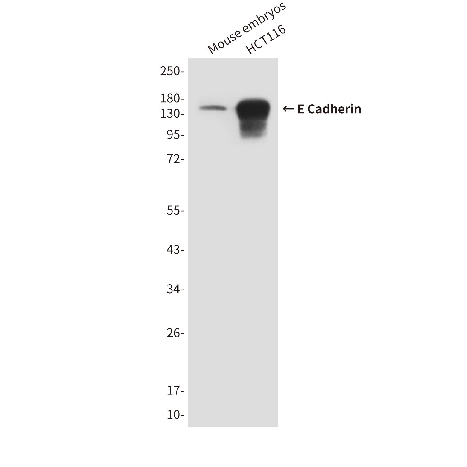 Anti-E Cadherin (6B10) Mouse Monoclonal Antibody