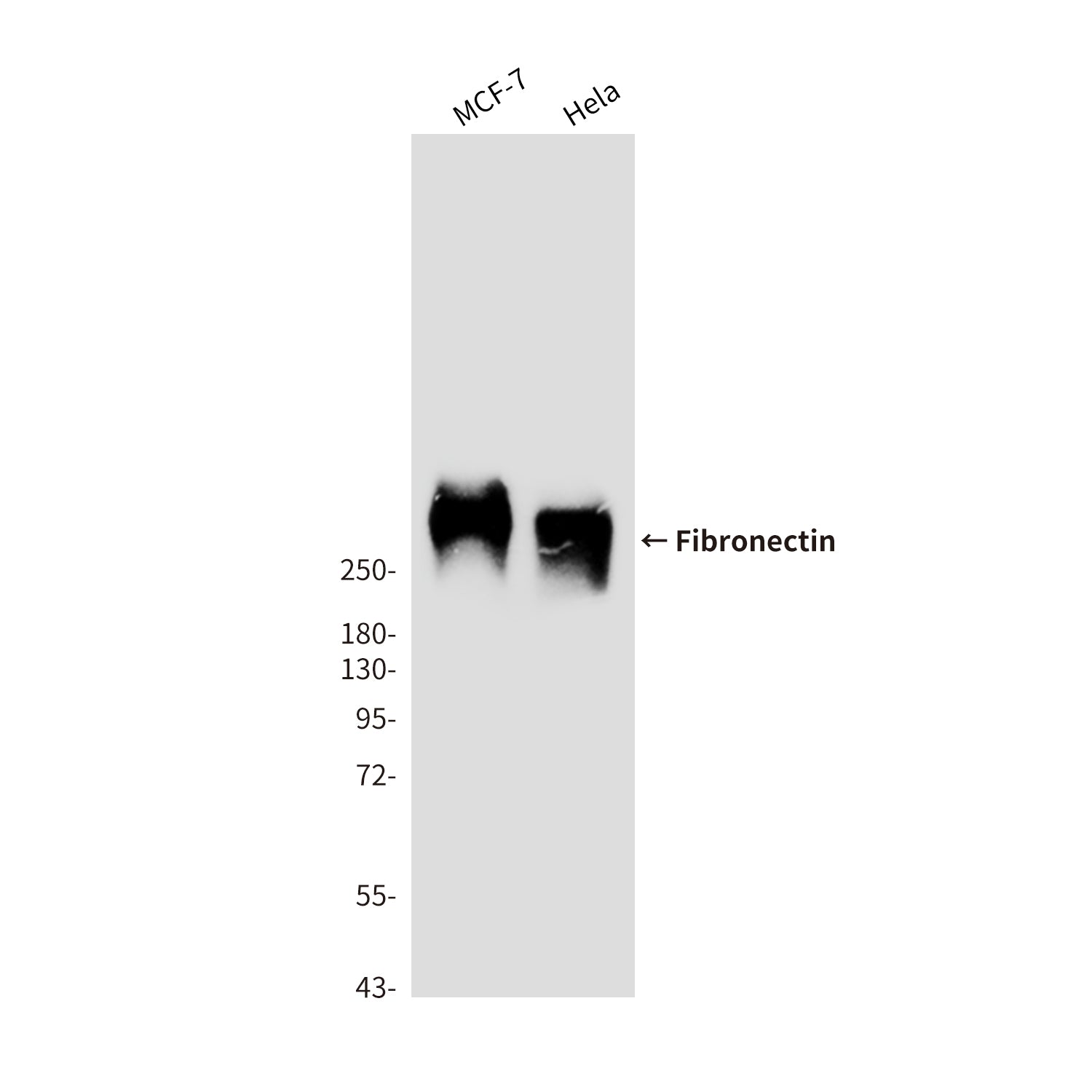 Anti-Fibronectin (1E2) Mouse Monoclonal Antibody