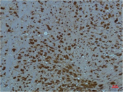 Anti-PI3 Kinase p85 alpha (1C8) Mouse Monoclonal Antibody