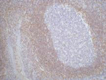 Anti-Bcl2 (3H5) Mouse Monoclonal Antibody