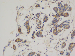 Anti-Bcl2 (3H5) Mouse Monoclonal Antibody
