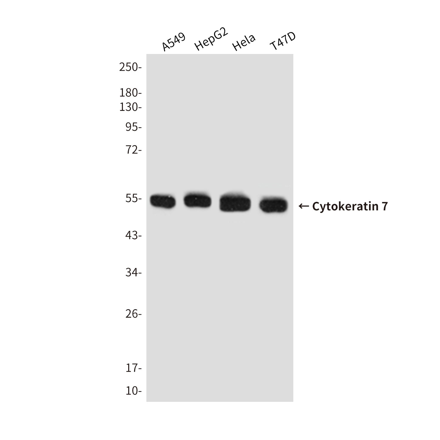 Anti-Cytokeratin 7 Mouse Monoclonal Antibody