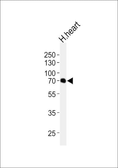 Anti-CLPX Rabbit Polyclonal Antibody