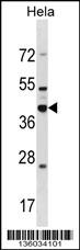 Anti-DND1 Rabbit Polyclonal Antibody