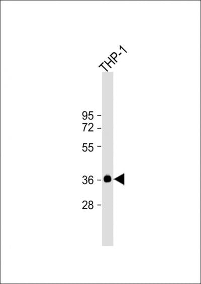 Anti-IKB alpha Rabbit Polyclonal Antibody