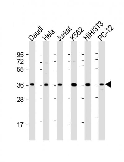 Anti-IKB alpha Rabbit Polyclonal Antibody