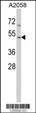 Anti-ACTR3 Rabbit Polyclonal Antibody