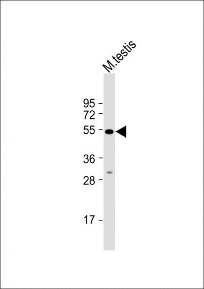 Anti-ORAI1 Rabbit Polyclonal Antibody