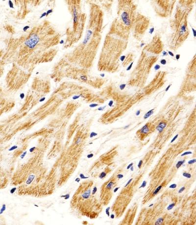 Anti-Smad1 Rabbit Polyclonal Antibody