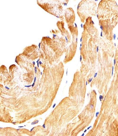 Anti-Smad1 Rabbit Polyclonal Antibody