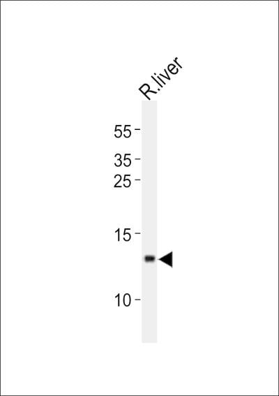 Anti-CXCL11 Rabbit Polyclonal Antibody