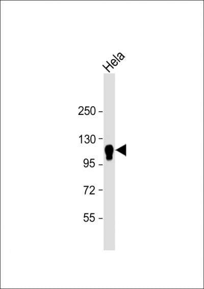 Anti-CYLD (5G4) Mouse Monoclonal Antibody