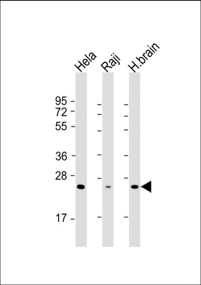 Anti-Rab14 (7A6) Mouse Monoclonal Antibody