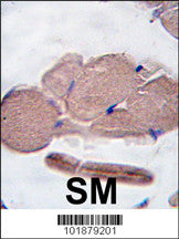 Anti-Myostatin Rabbit Polyclonal Antibody