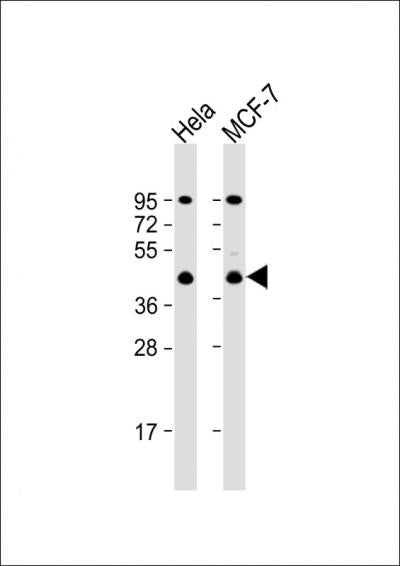 Anti-ACTR2 Rabbit Polyclonal Antibody