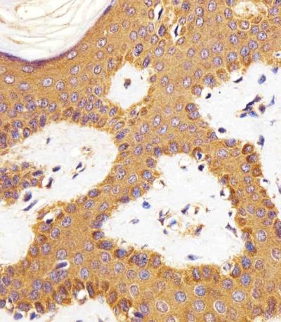 Anti-Rac1 (1F4) Mouse Monoclonal Antibody