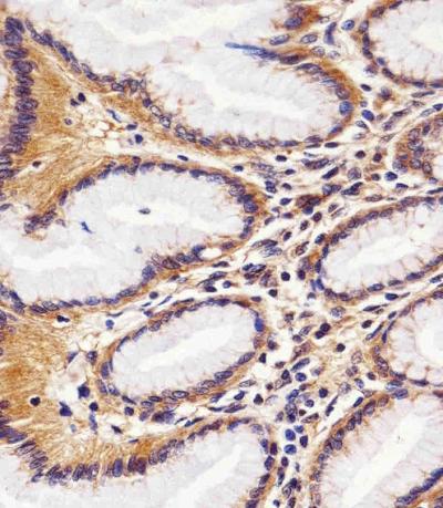Anti-Rac1 (1F4) Mouse Monoclonal Antibody