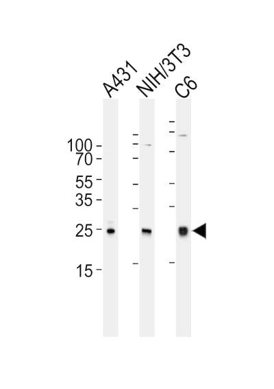 Anti-Rac1 (1F4) Mouse Monoclonal Antibody