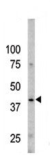 Anti-Phospho-Caspase 9 (Ser196) Rabbit Polyclonal Antibody