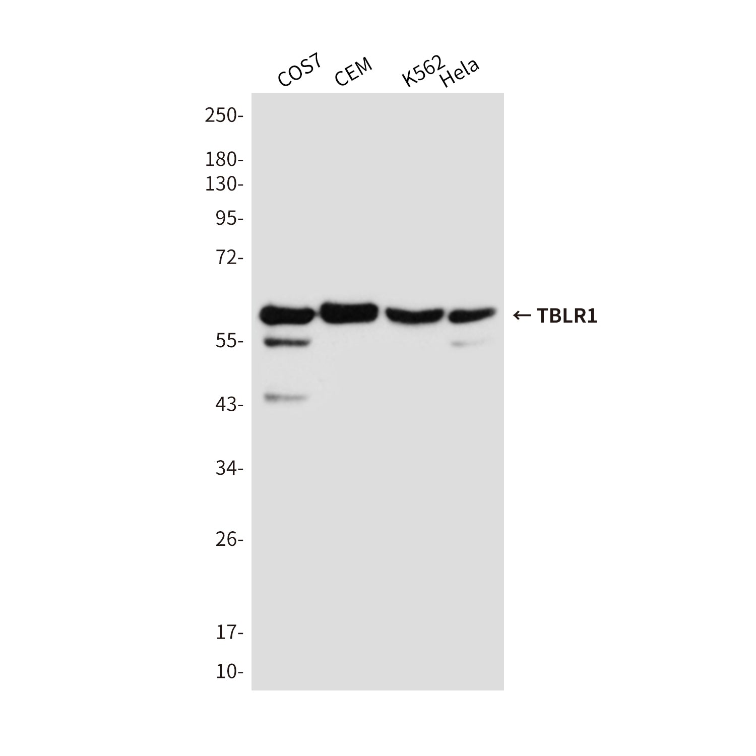 Anti-TBLR1 Mouse Monoclonal Antibody