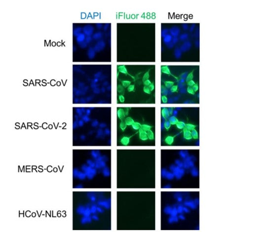 Anti-Human Anti-SARS CoV/CoV 2 NP