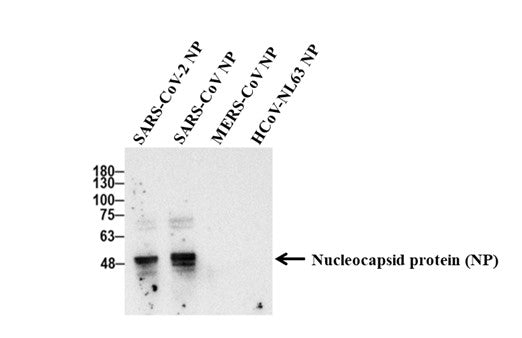 Anti-Human Anti-SARS CoV/CoV 2 NP