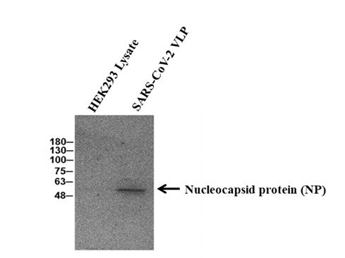 Anti-Human Anti-SARS CoV/CoV 2 NP