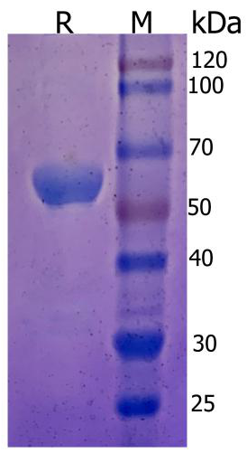 Anti-Human Anti-SARS CoV 2 Spike RBD（hFC）