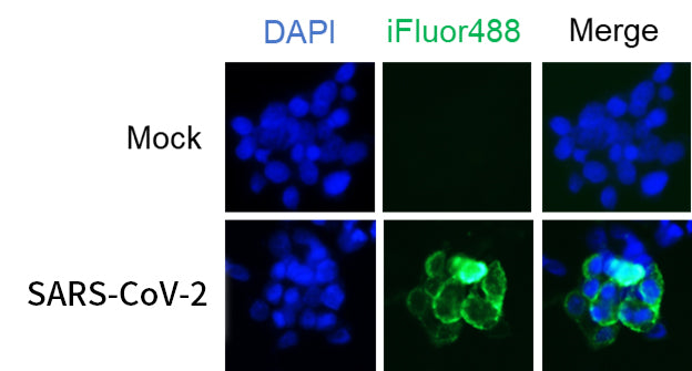 Anti-SARS CoV 2 Spike Mouse Monoclonal Antibody