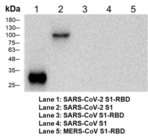 Anti-SARS CoV 2 Spike Mouse Monoclonal Antibody