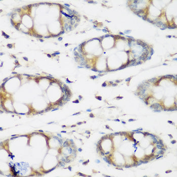 Anti-BMP2 Rabbit Polyclonal Antibody