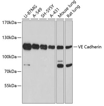 Anti-Cadherin 5 Rabbit Polyclonal Antibody
