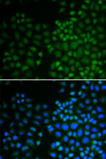 Anti-NR0B2 Rabbit Polyclonal Antibody
