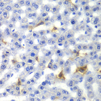 Anti-NR0B2 Rabbit Polyclonal Antibody