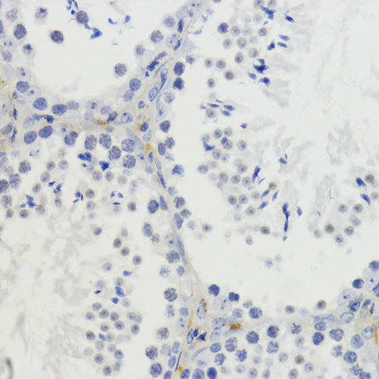 Anti-DiMethyl-Histone H4 (Lys20) Rabbit Polyclonal Antibody