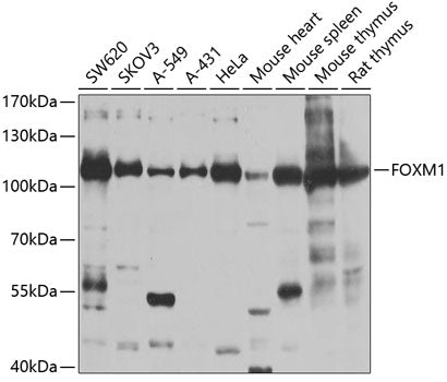 Anti-FOXM1 Rabbit Polyclonal Antibody