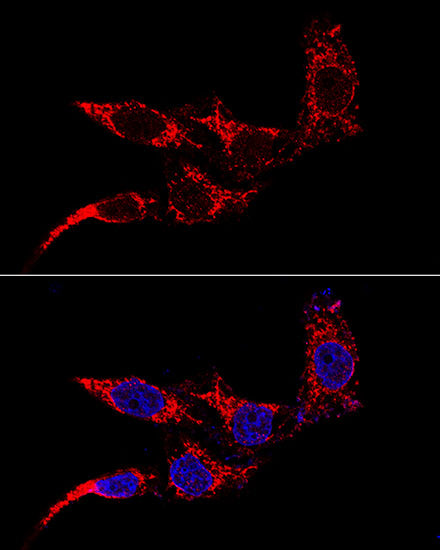 Anti-Mitochondrial Fission 1 Protein Rabbit Polyclonal Antibody